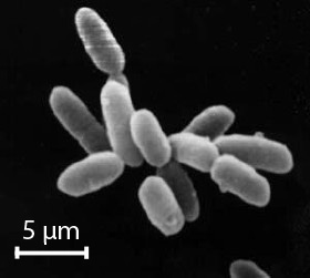 塩分濃度がほぼ飽和状態に近い水中に生息するハロバクテリアは、現在では古細菌として認識されている。