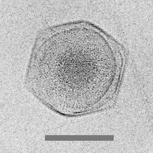 CroV巨大ウイルスのクライオ電子顕微鏡写真（スケールバー＝0.2μm）