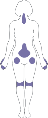 最も影響を受けている部分を示す女性の体の輪郭