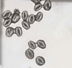 花粉粒