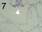 小麦の葉の気孔下腔における Zymoseptoria tritici の分生子形成の開始 (矢印の先)。