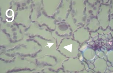 耐性品種の主葉に Zymoseptoria tritici によって引き起こされる典型的な感染。アポプラスト (矢印) 内の菌類密度の低さと、細胞間菌糸の存在に対する葉肉細胞 (矢印の先端)、特に葉緑体の反応に注目してください。