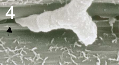 Zymoseptoria tritici の分生胞子発芽管による小麦の葉の気孔 (矢印) への侵入。