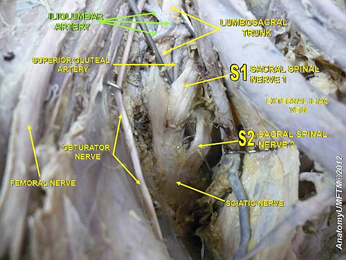 腸腰動脈