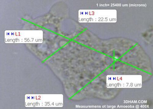 大型アメーバの400倍での計測