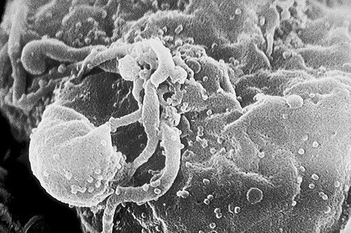 細胞から出芽するHIVウイルス粒子の電子顕微鏡写真