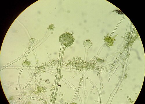 光学顕微鏡下で観察した、微細菌類A. oryzaeの分生子柄と分生子。