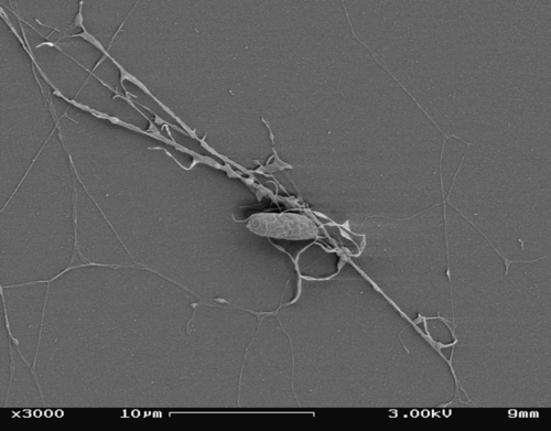 SEMで観察したアプラノキトリウム属（Aplanochytrium sp.）