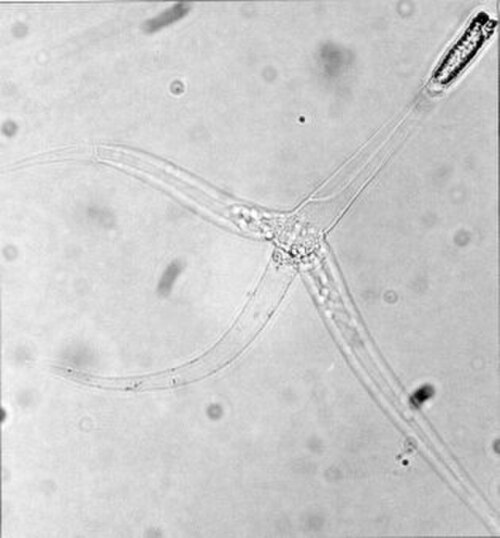 ミクソボルス・セレブラリスなどの粘液胞子虫は単細胞の寄生虫で、体長は20μmを超えることはない。