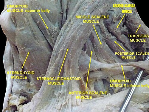 斜角筋。首の筋肉。側面図。