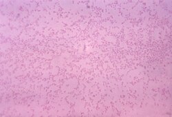 グラム染色された顕微鏡写真には、多数の「パスツレラ・ムルトシダ」菌が写っている。