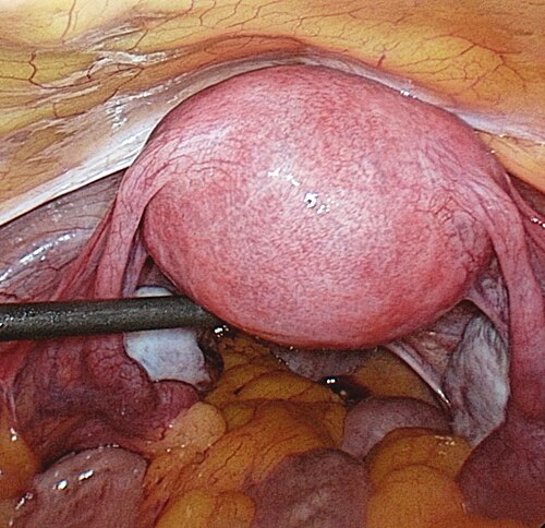 腹部内部にある女性生殖器系の写真
