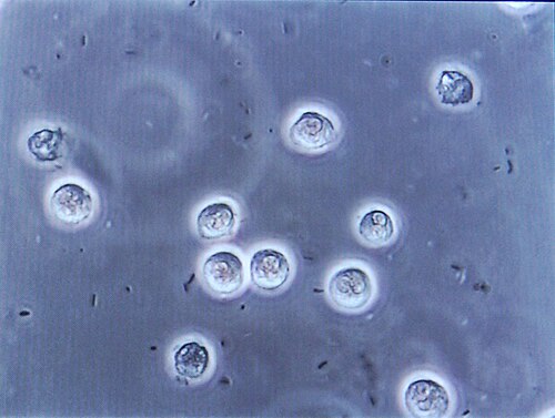 青い液体に浮かぶ円形の微生物