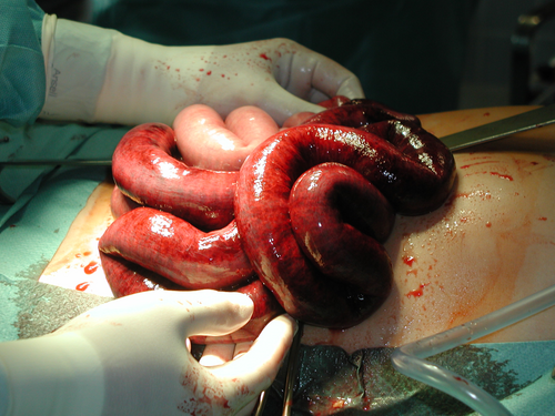 開腹手術中の虚血性小腸。