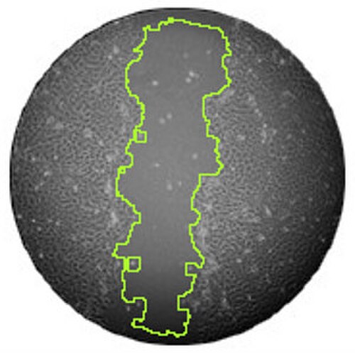 ペトリ皿内で皮膚細胞が治癒していく様子を捉えた白黒画像