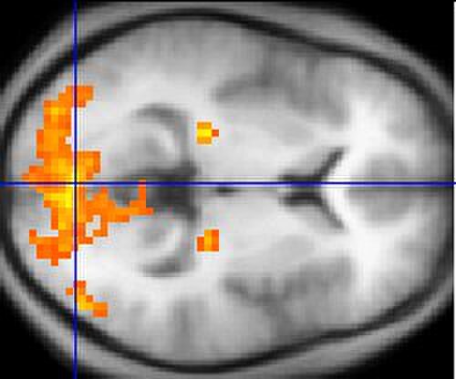 人間の脳の水平断面のモノクロ fMRI 画像。主に後部のいくつかの領域がオレンジ色と黄色で強調表示されています。