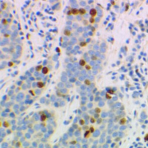 青色に染色された細胞と、栗色の免疫標識された細胞の顕微鏡写真