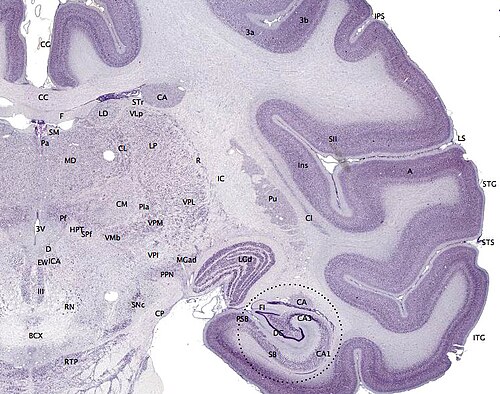 海馬のCA1領域とCA3領域を示す脳の断面図。