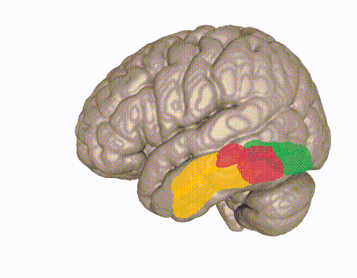 紡錘状回を3Dで表示した図。黄色：側頭葉、赤色：後頭側頭葉、緑色：後頭葉