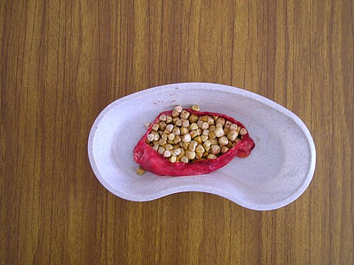 胆嚢を開いて小さなコレステロール胆石を確認した。