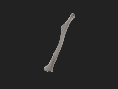 3D画像