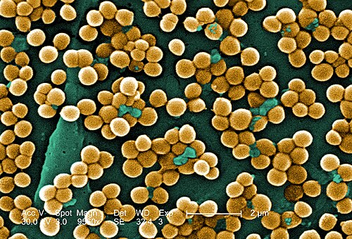 着色された顕微鏡写真：球状の細菌がブドウの房のように集まっている。