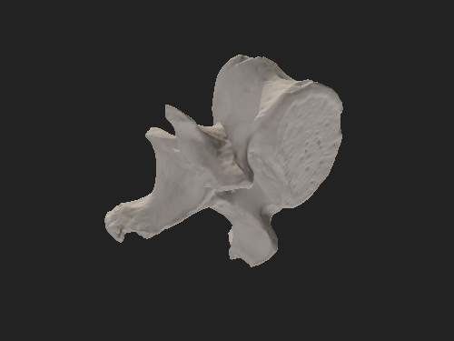 腰椎の3D画像
