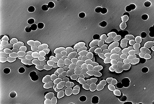白黒顕微鏡写真：球状の細菌が2つずつ集まって、灰色の視野を横切るように帯状に広がっている。