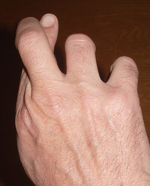 人差し指と中指を第一関節で交差させた手の写真。