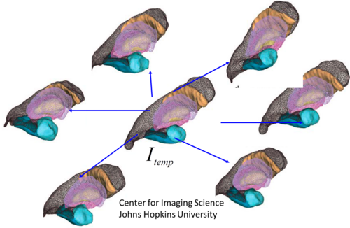 MRI 画像から生成された複数の座標系と共通のテンプレート座標系を生成する様子を示す図。