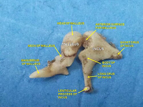 Aditory ossicles. Incus and malleus. Deep dissection.