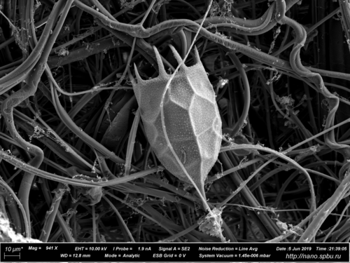 輪形動物Keratella cochlearisの蝸牛室