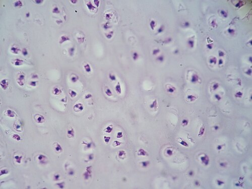 気管軟骨の拡大断面