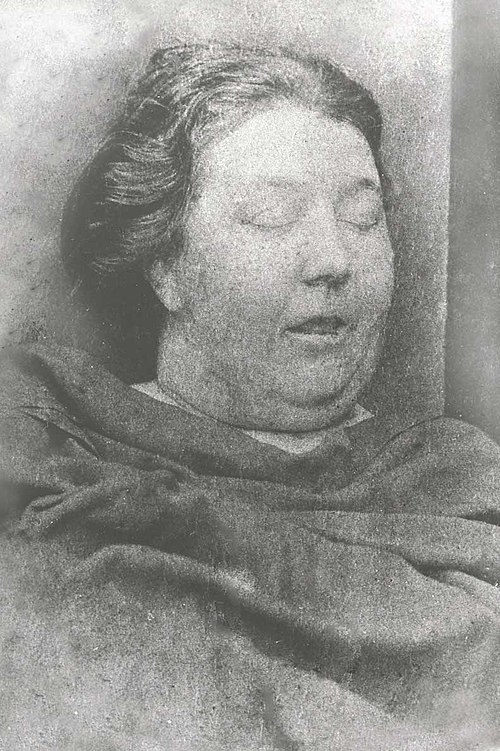 タブラムの遺体写真:栄養たっぷりの中年女性