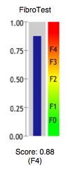 FibroTestの結果
